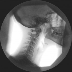 C-spine QF image for Chiro and Man Therapies
